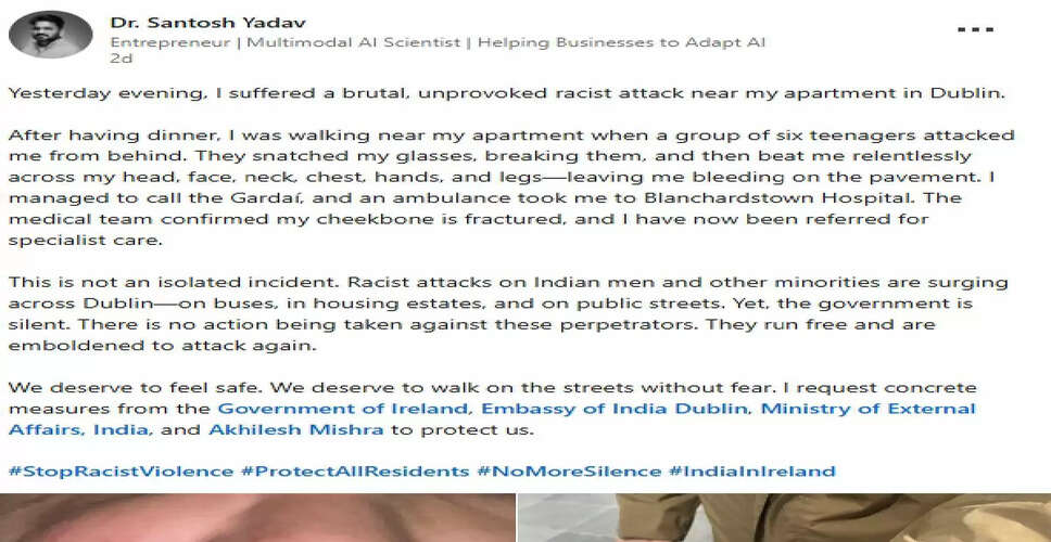 डबलिन में भारतीय उद्यमी पर हमले की बढ़ती घटनाएं