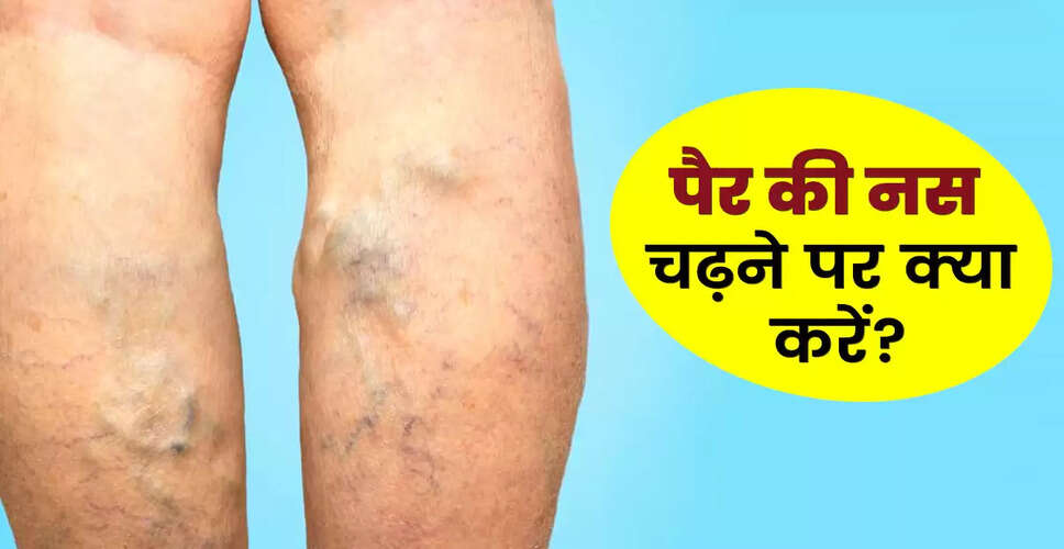 पैर की नस चढ़ने के कारण और उपाय: जानें कैसे पाएं राहत