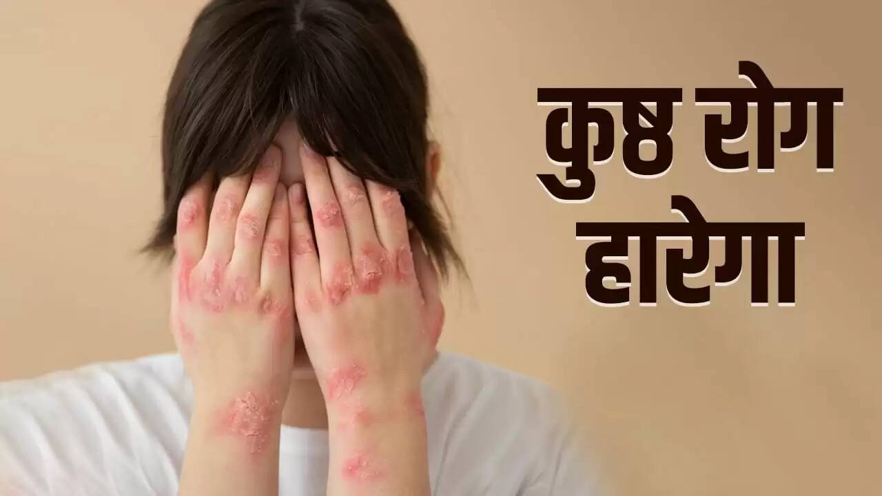 भारत में कुष्ठ रोग पर नियंत्रण: सफलता की कहानी और भविष्य की चुनौतियाँ