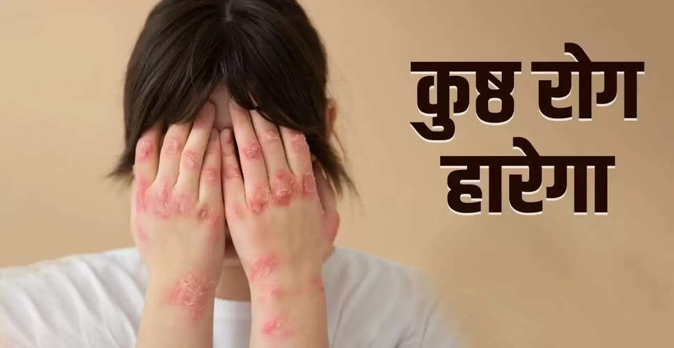 भारत में कुष्ठ रोग पर नियंत्रण: सफलता की कहानी और भविष्य की चुनौतियाँ