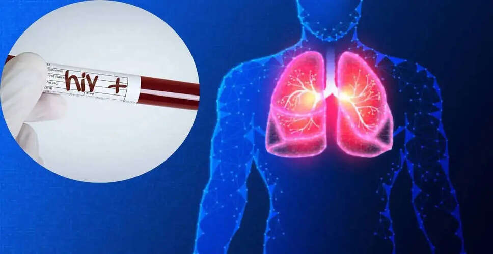 एचआईवी पॉजिटिव मरीजों के लिए पहली बार फेफड़े का सफल प्रत्यारोपण