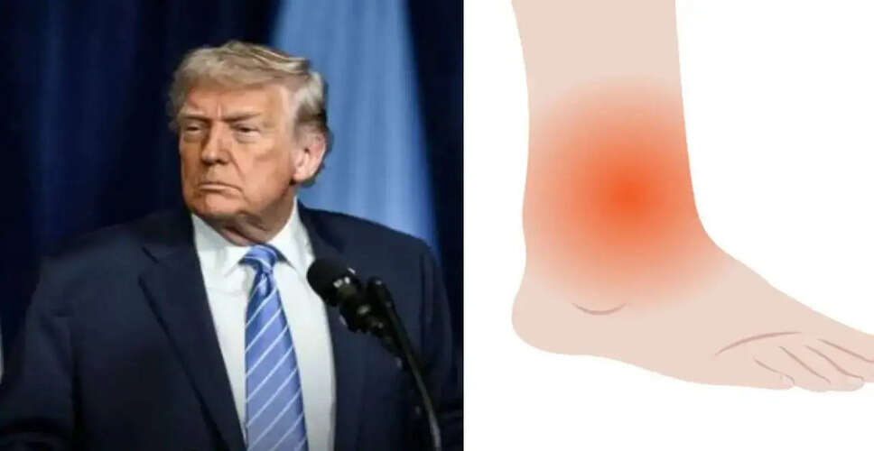 डोनाल्ड ट्रंप की स्वास्थ्य स्थिति पर चिंता: एंकल सूजन और चलने में कठिनाई