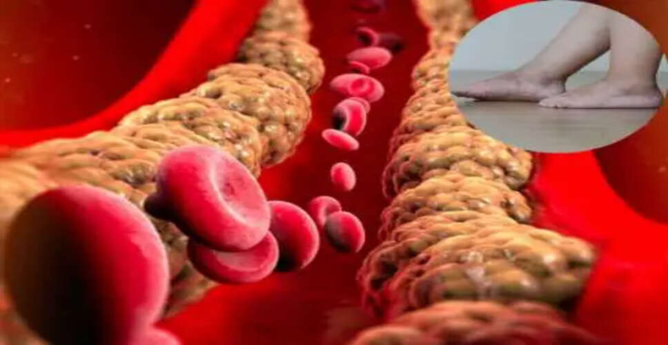 हाई एलडीएल कोलेस्ट्रॉल: जानें इसके खतरनाक लक्षण और सावधानियाँ