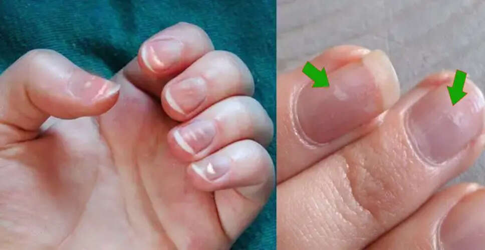 नाखूनों पर धब्बों के संकेत: जानें क्या कहते हैं आपके हाथ
