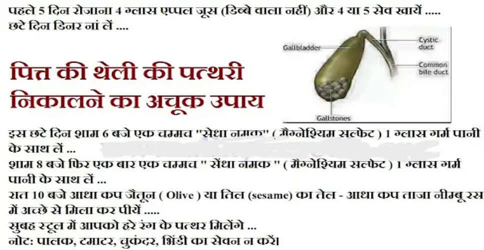 गाल ब्लैडर स्टोन के लिए प्राकृतिक उपचार: जानें कैसे करें