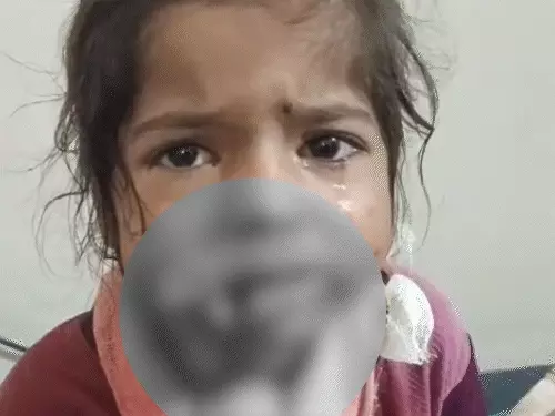 राजस्थान में आवारा कुत्ते के हमले से बच्चा घायल