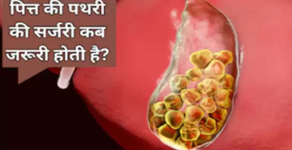 पित्त की थैली में पथरी: लक्षण, कारण और उपचार