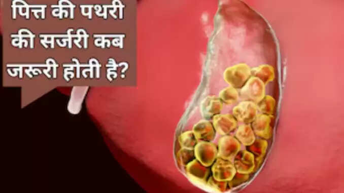 पित्त की थैली में पथरी: लक्षण, कारण और उपचार