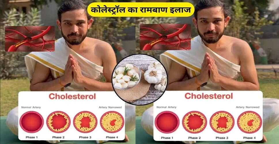 लहसुन से कोलेस्ट्रॉल नियंत्रण: घरेलू उपाय और लाभ