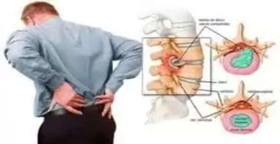 कमर दर्द से राहत पाने के लिए प्रभावी घरेलू उपाय