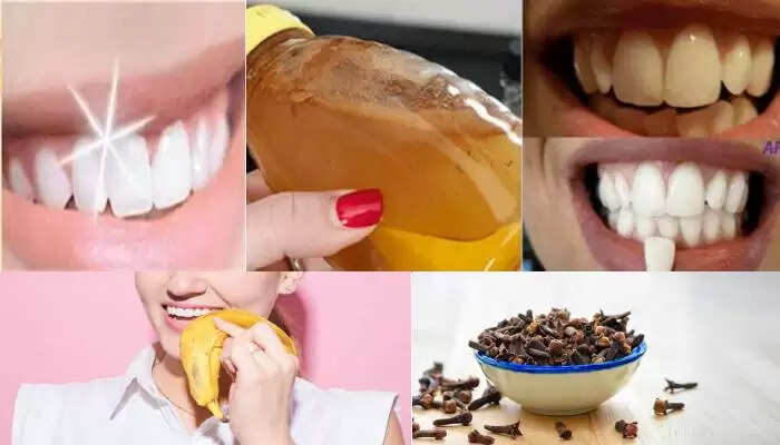 दांतों को चमकाने के लिए घरेलू नुस्खे: 15 दिनों में पाएं सफेद दांत