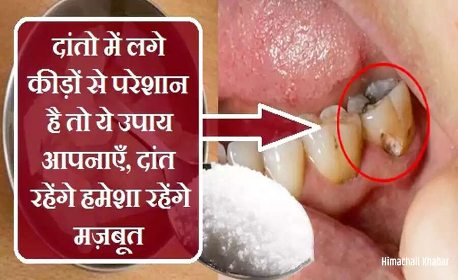 दांतों में कीड़ों से छुटकारा पाने के उपाय और कारण