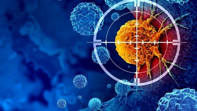 कैंसर के प्रारंभिक संकेत: पहचानें और समय पर करें जांच