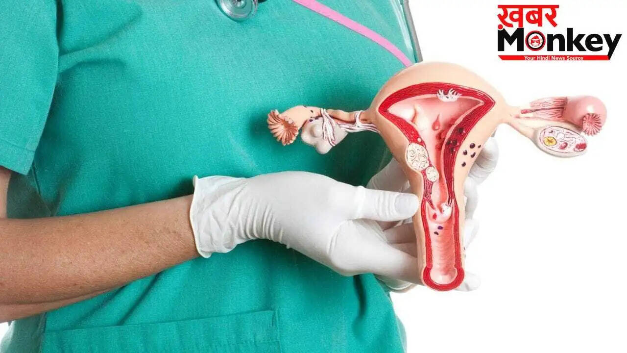 ओवरी सिस्ट: बिना सर्जरी के ठीक होने की संभावनाएं और संकेत