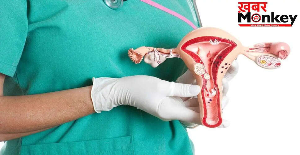 ओवरी सिस्ट: बिना सर्जरी के ठीक होने की संभावनाएं और संकेत