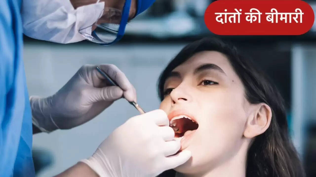 दांतों में कैविटी: लक्षण, कारण और उपचार के तरीके