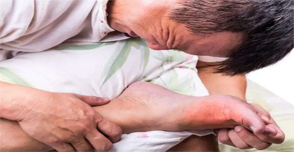 यूरिक एसिड: लक्षण, कारण और नियंत्रण के उपाय