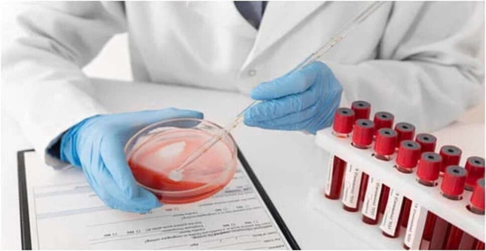 40 के बाद पुरुषों के लिए स्वास्थ्य जांच की आवश्यकता