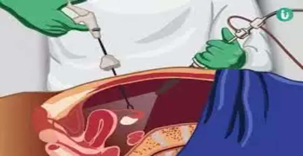 डॉक्टरों की गलती से कैंसर मरीज का प्राइवेट पार्ट हटाया गया