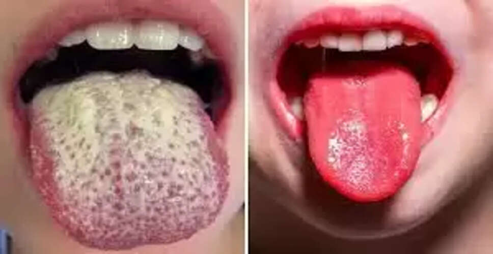 जीभ के रंग और आकार से जानें स्वास्थ्य की स्थिति
