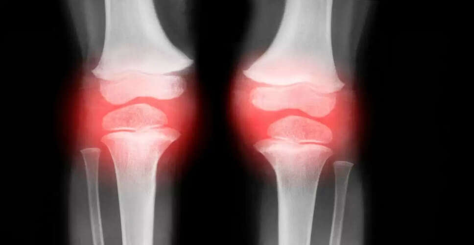 कमजोर हड्डियों के कारण और बचाव के उपाय