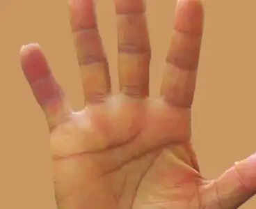 हथेली की रेखाएं और दांपत्य जीवन में धन का अधिकार