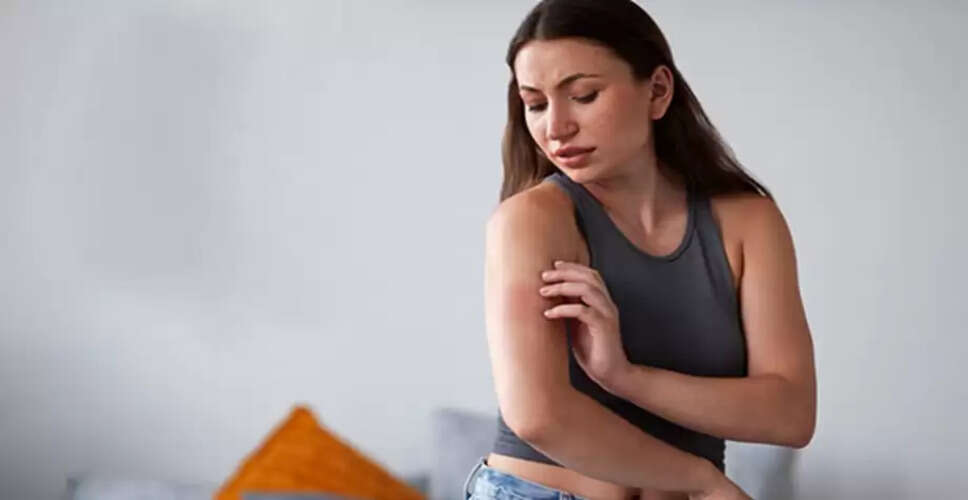 गर्मी में त्वचा की जलन के लिए घरेलू उपचार