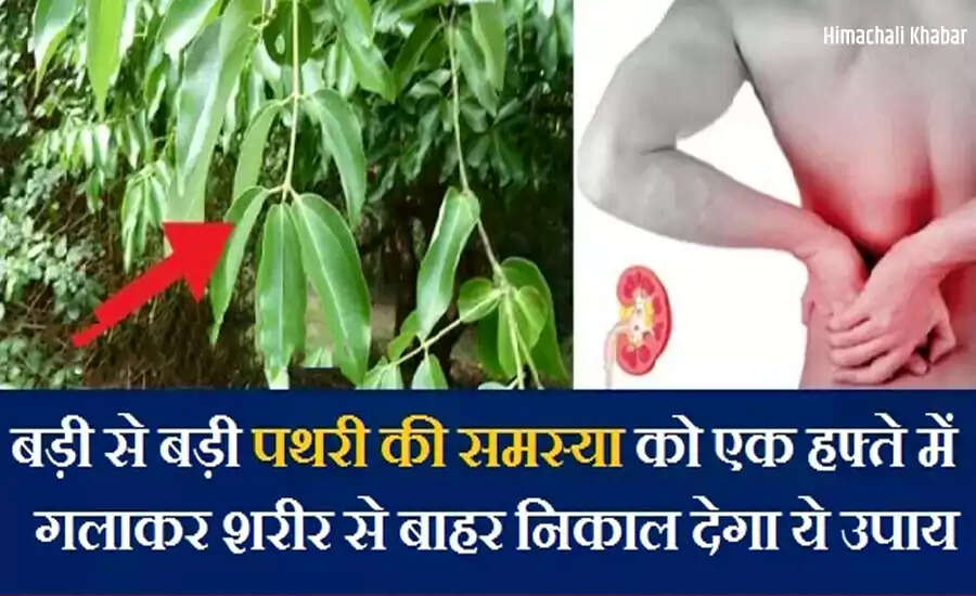 पथरी की समस्या: घरेलू उपचार और सावधानियाँ