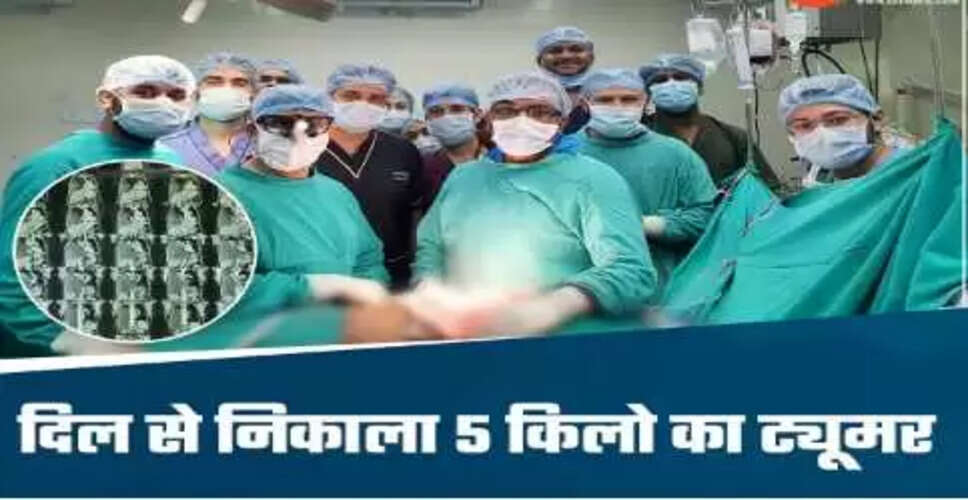 छत्तीसगढ़ में डॉक्टरों ने निकाला पांच किलो का ट्यूमर, मरीज स्वस्थ