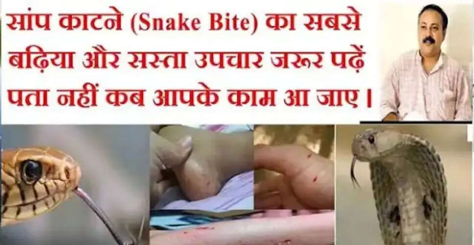 साँप के डंक से बचाव के उपाय: जानें कैसे करें प्राथमिक सहायता