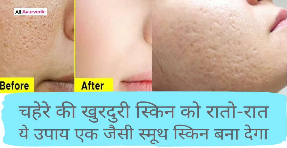 चेहरे के गड्ढों से छुटकारा पाने के लिए घरेलू उपाय
