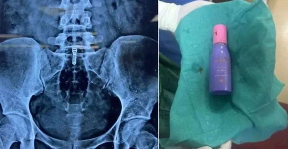 दिल्ली में अजीबोगरीब घटना: लड़की ने यौन सुख के लिए बोतल डाली, अस्पताल में हुई सर्जरी