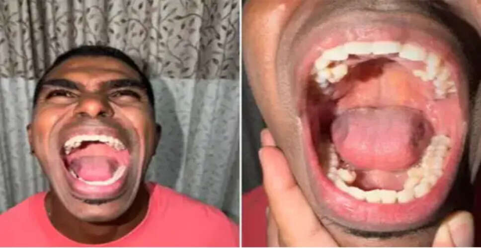 मलेशिया के प्रताब मुनियांडी ने बनाए अनोखे 42 दांतों का रिकॉर्ड