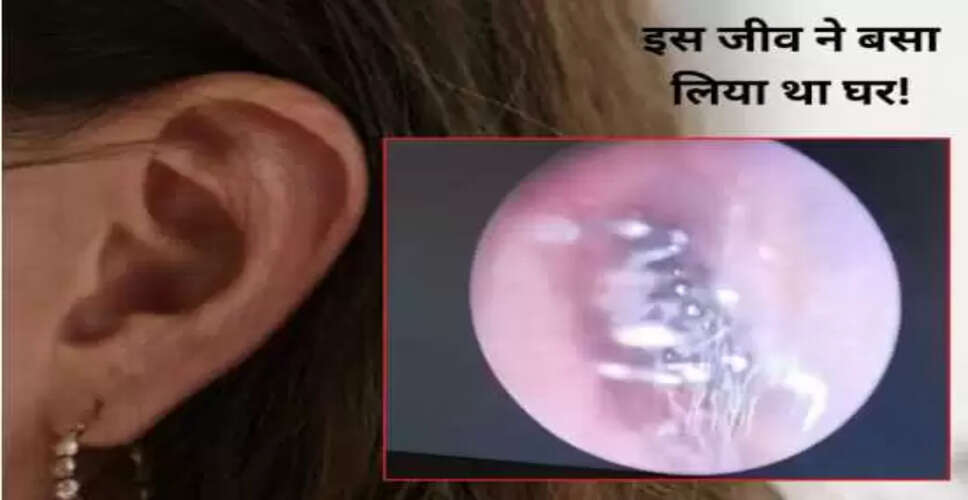 चीन में महिला के कान में मिली मकड़ी का परिवार, डॉक्टरों ने किया सफल इलाज