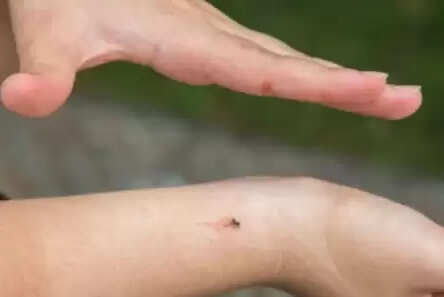 मच्छर मारने के बाद हाथ न धोने के स्वास्थ्य पर प्रभाव