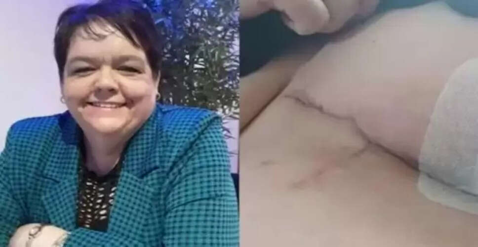 महिला की ब्रा से हुई खरोंच ने उसे 8 दिनों तक कोमा में रखा