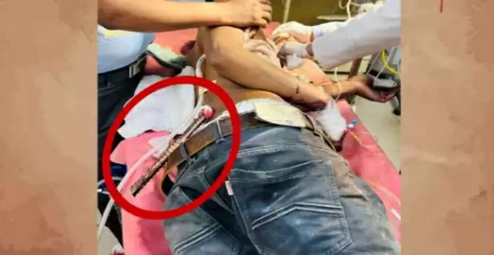 सड़क दुर्घटना में युवक की जान बचाने वाली सर्जरी की कहानी