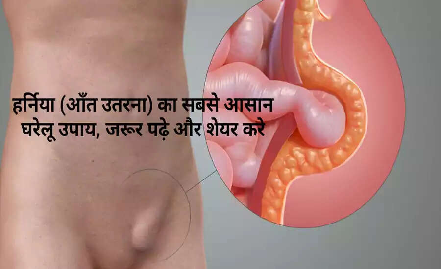हर्निया: लक्षण, कारण और उपचार के तरीके