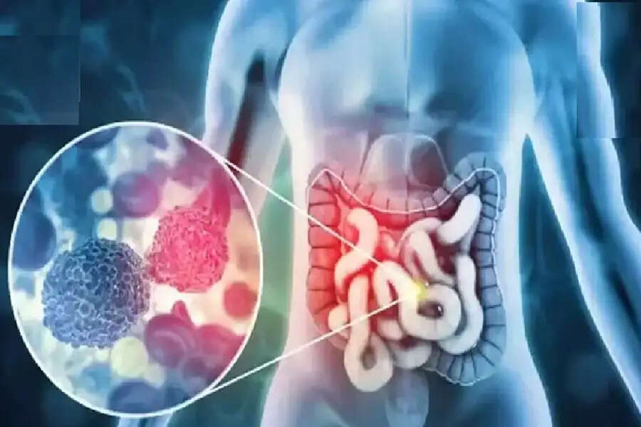 कैंसर के प्रारंभिक संकेत: जानें कब करें डॉक्टर से संपर्क