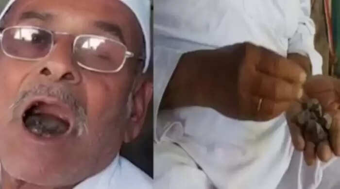 80 वर्षीय बुजुर्ग की अनोखी आदत: रोजाना पत्थर खाने वाले रामभाऊ बोडके