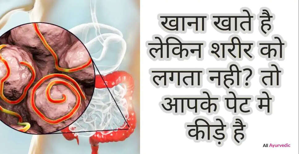 पेट के कीड़ों से राहत पाने के घरेलू उपाय