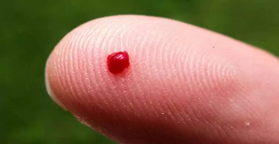 खून बहने पर तुरंत रोकने के घरेलू उपाय