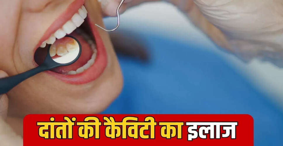 क्या दांतों की कैविटी अपने आप ठीक हो सकती है? जानें विशेषज्ञ की राय
