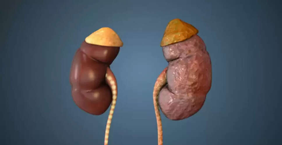 गुर्दे की विफलता के प्रारंभिक संकेत और उनकी पहचान