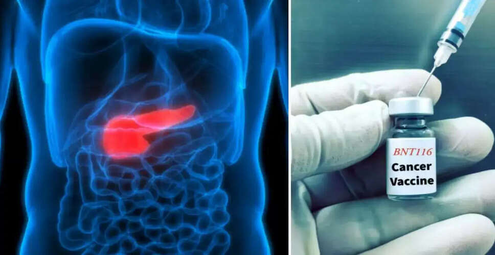 पैंक्रियाटिक कैंसर के लिए व्यक्तिगत mRNA वैक्सीन: नई उम्मीद की किरण