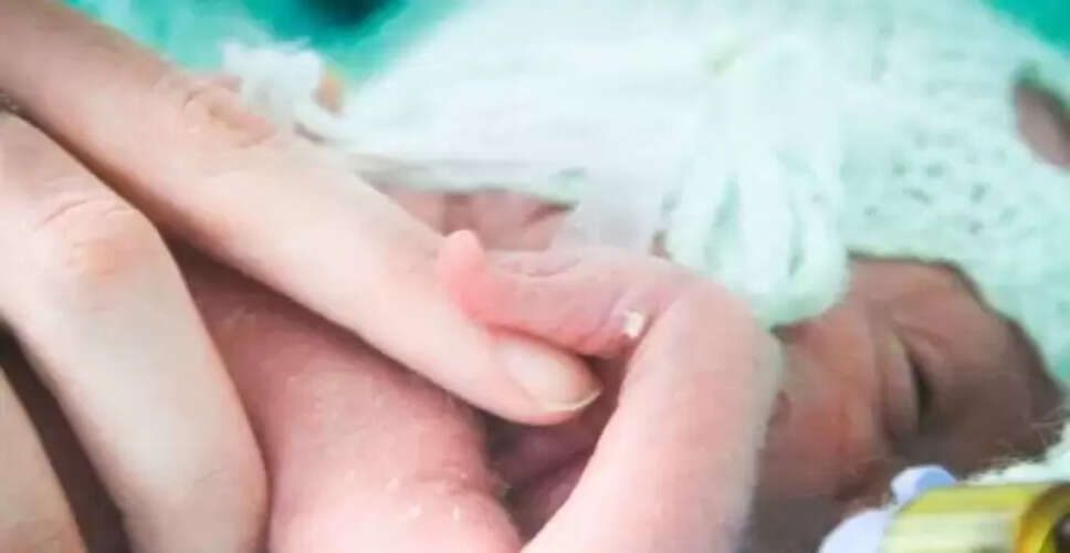 बरेली में जन्मा एलियन जैसा बच्चा, जानें इसके बारे में
