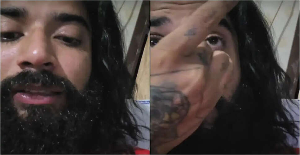 अनुराग डोभाल की आत्महत्या की कोशिश के बाद सोशल मीडिया पर मिला प्यार