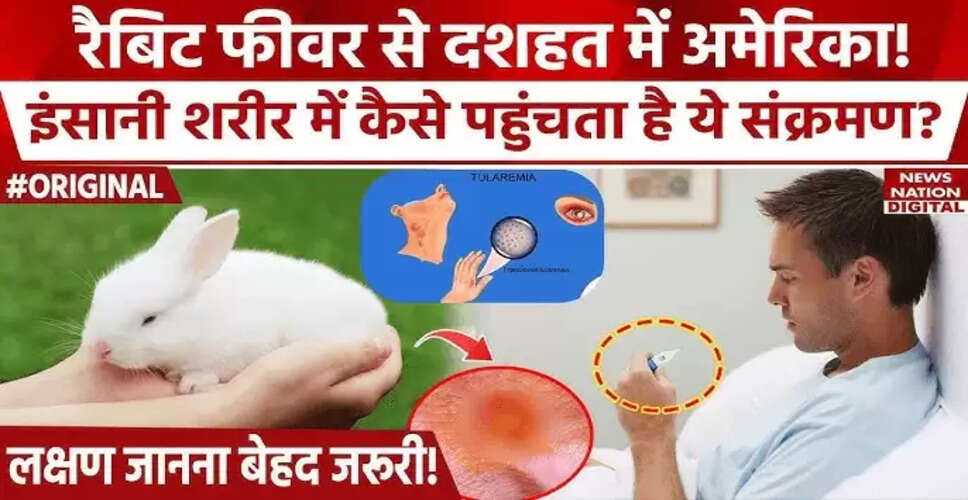 अमेरिका में रैबिट फीवर का बढ़ता खतरा: जानें लक्षण और बचाव के उपाय