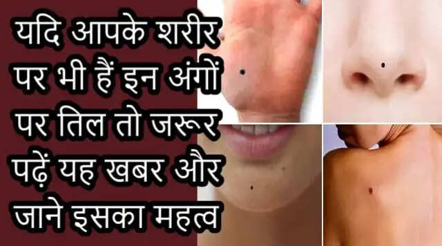 शरीर पर तिल: जानिए इनके अर्थ और प्रभाव