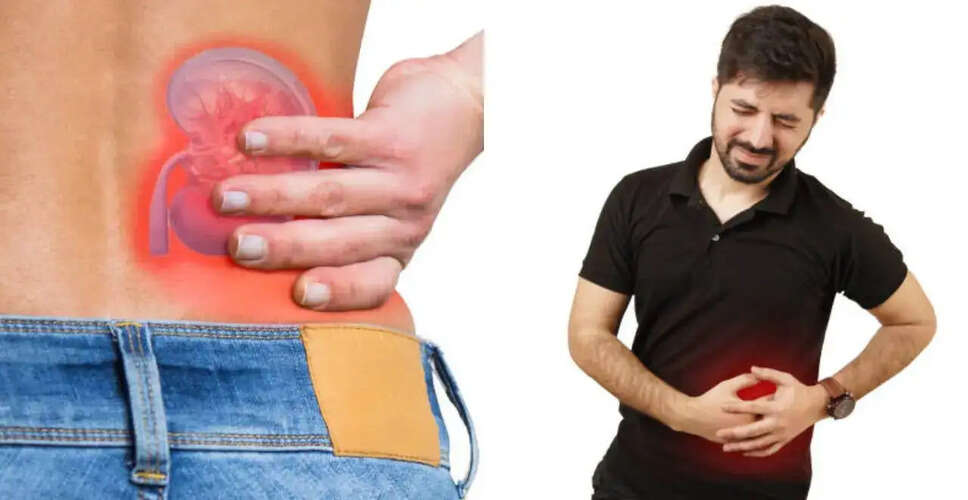 गुर्दे की पथरी: कारण, लक्षण और रोकथाम के उपाय